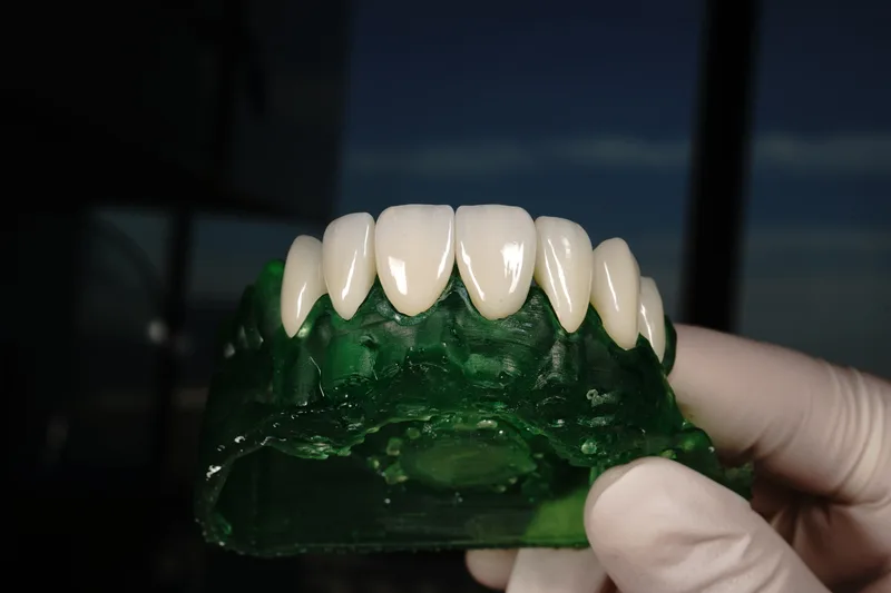 Planificación digital de una sonrisa