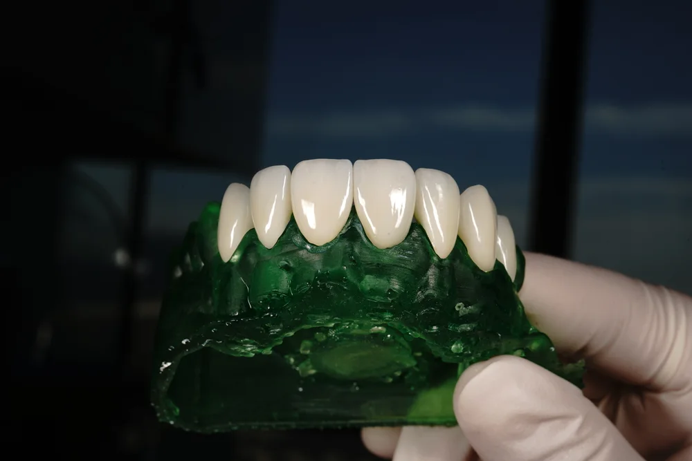 Planificación digital de una sonrisa