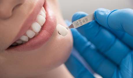 anestesia dental biobio dental